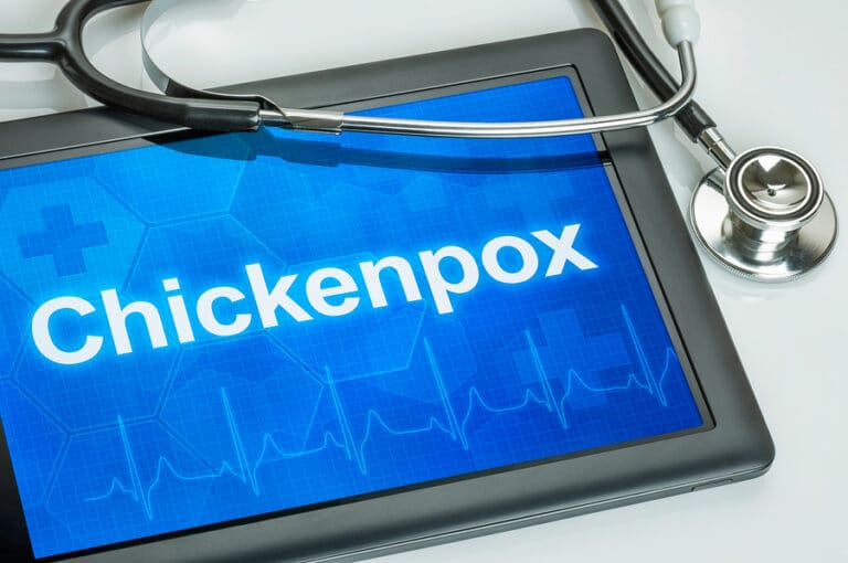 Home Care in Gainesville GA: Signs and Symptoms of Chickenpox