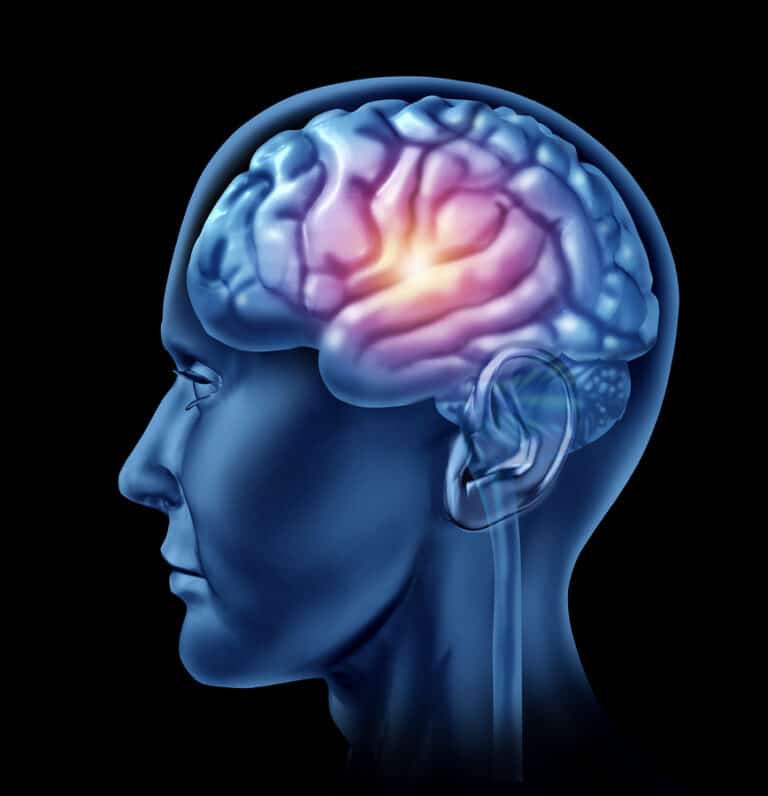 Elder Care in Braselton GA: Traumatic Brain Injuries