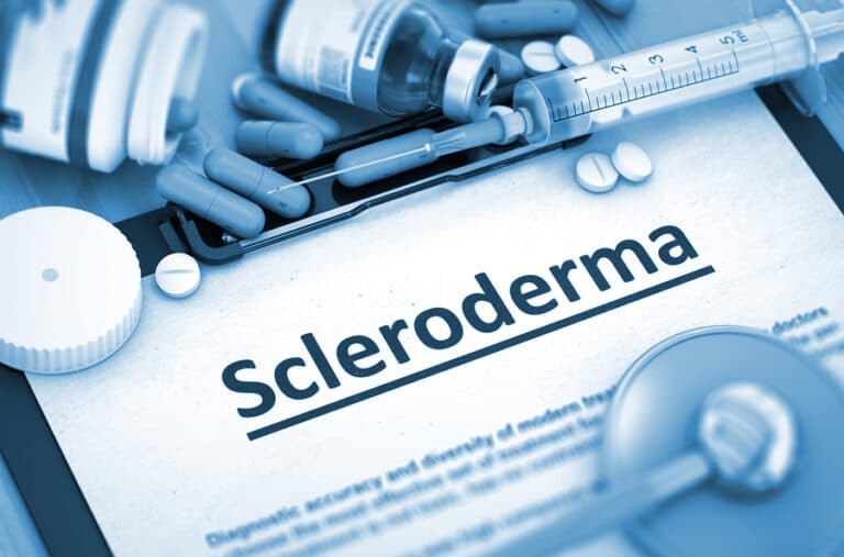 Caregiver in Cumming GA: Scleroderma Awareness Month