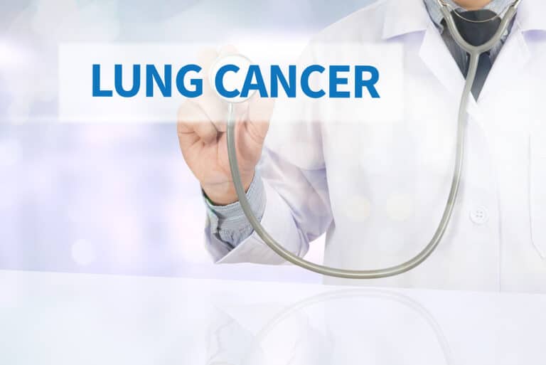 Elder Care in Dacula GA: Lung Cancer Treatment Risks